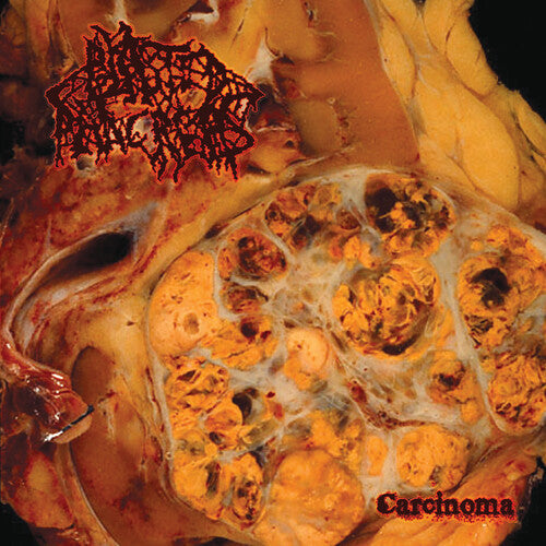 Blasted Pancreas: Carcinoma - COMPACT DISCS