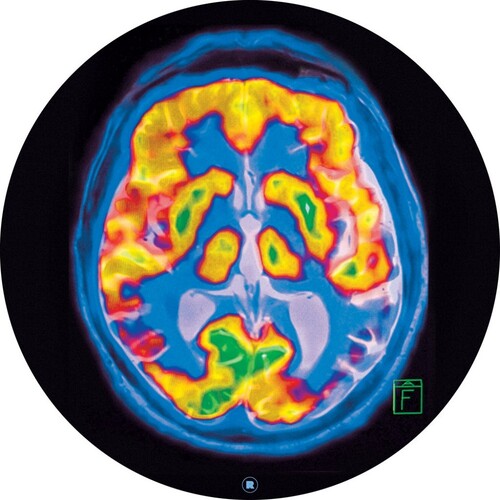 Frankey & Sandrino: Brainscan - 12-INCH SINGLE